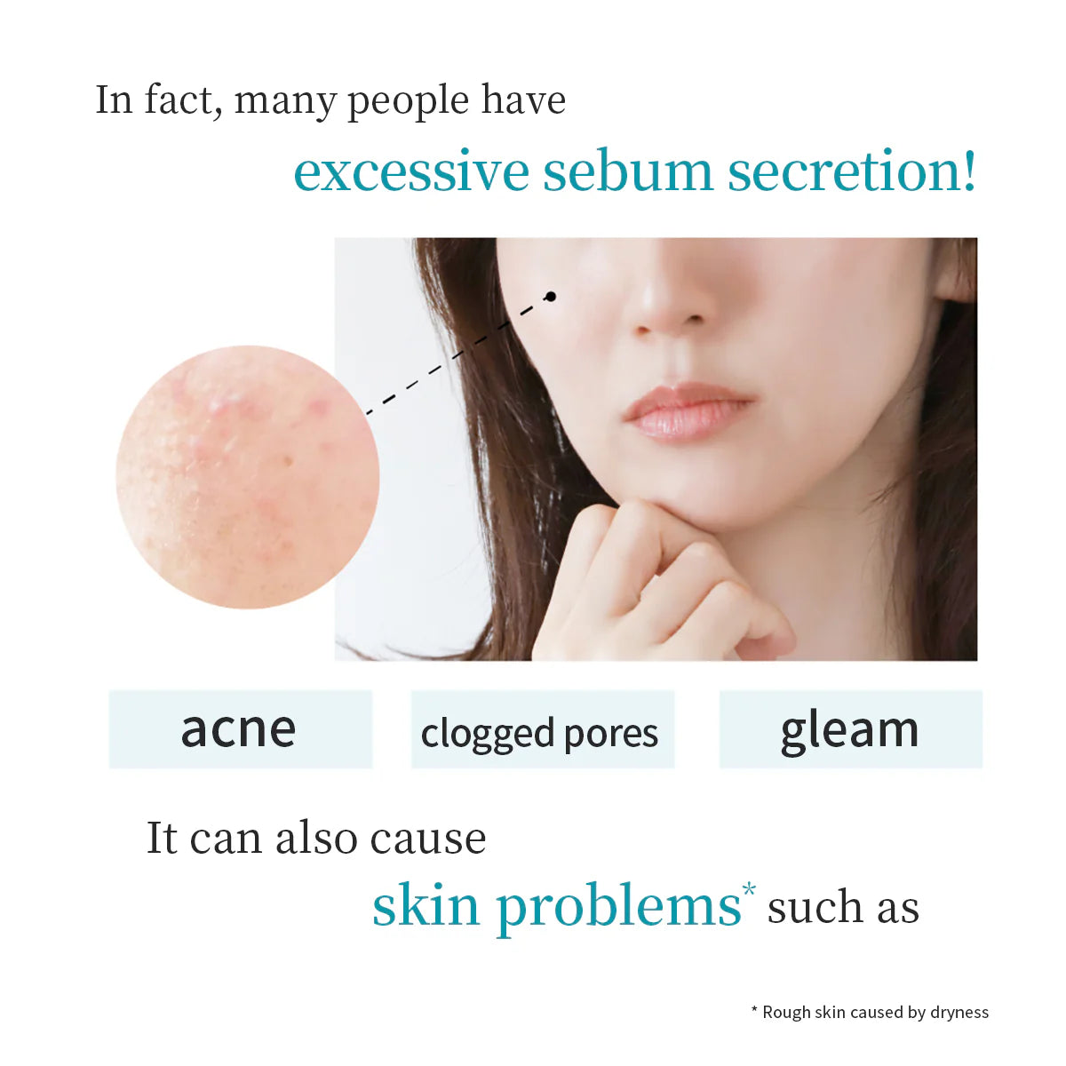 Fractional CC Needle Serum AZ